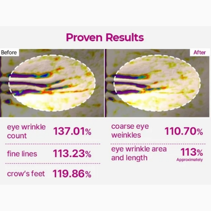 Before and after comparison of eye wrinkle count with numerical results on a white background.