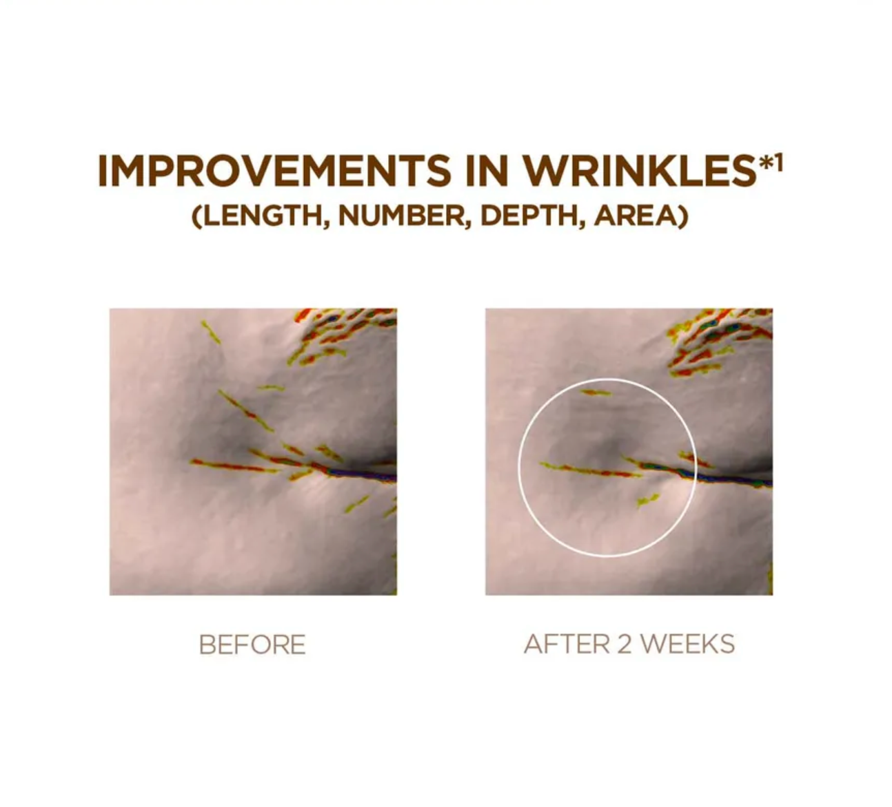 Before and after comparison of wrinkles on skin with text indicating improvements.