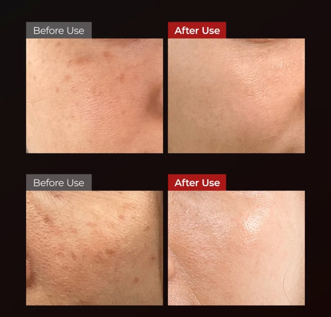 Before and after use comparison of skin treatment on a black background