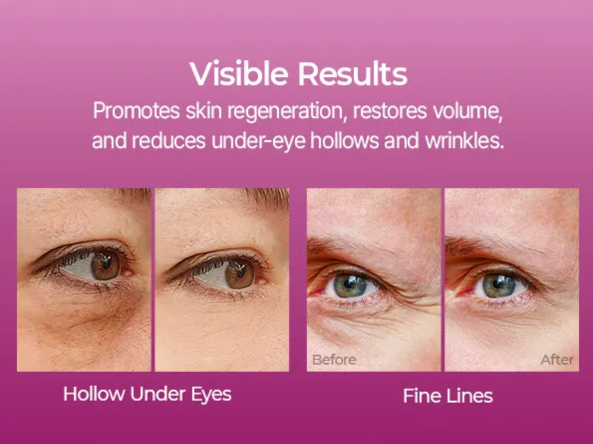 Before and after effects of eye cream on skin with text about visible results.